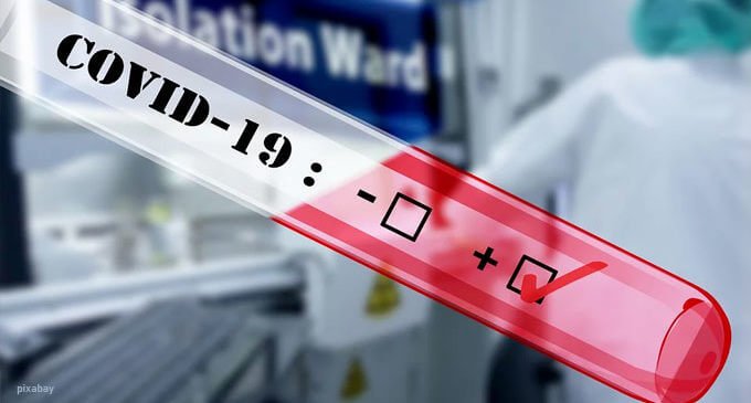 I pazienti COVID 19 positivi sono in totale 99, numero inalterato rispetto a ieri. Di questi, 17 pazienti necessitano di supporto respiratorio.